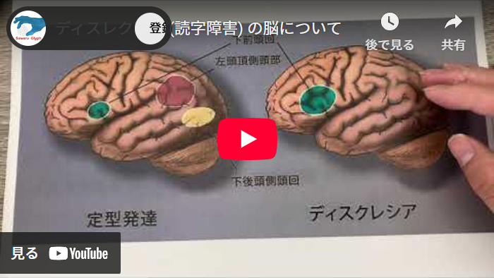 ディスレクシア（読字障害）の脳ついて　動画を再生