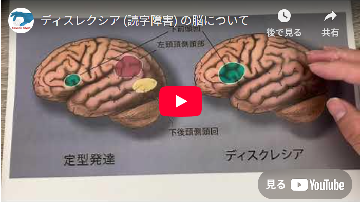 ディスレクシア（読字障害）の脳について　動画を再生する