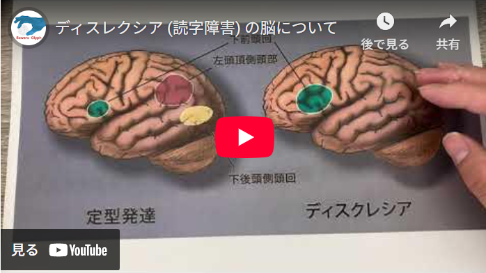 ディスレクシア（読字障害）の脳について　動画を再生する