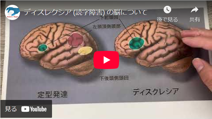 ディスクレシア（読字障害）の脳について　動画を再生する